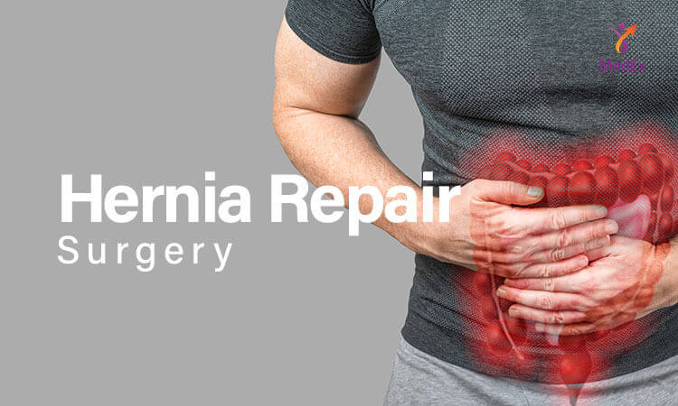 Hernia Repair Surgery