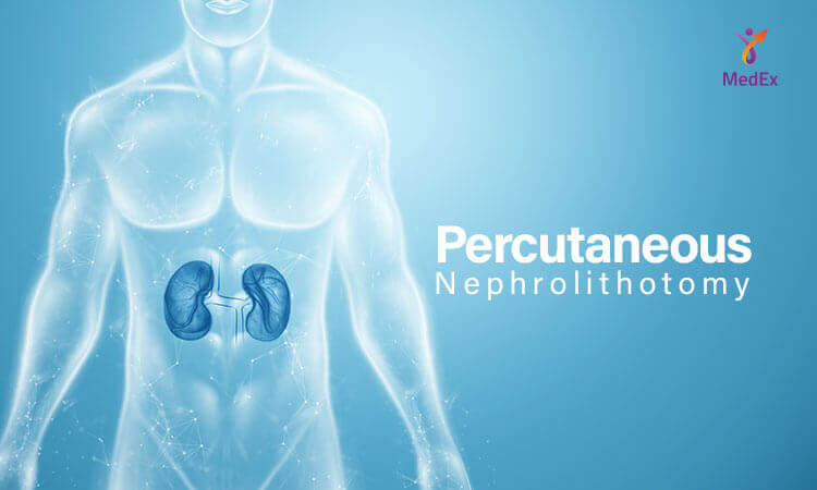 Percutaneous Nephrolithotomy