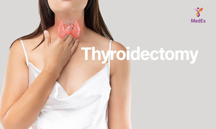 Thyroidectomy